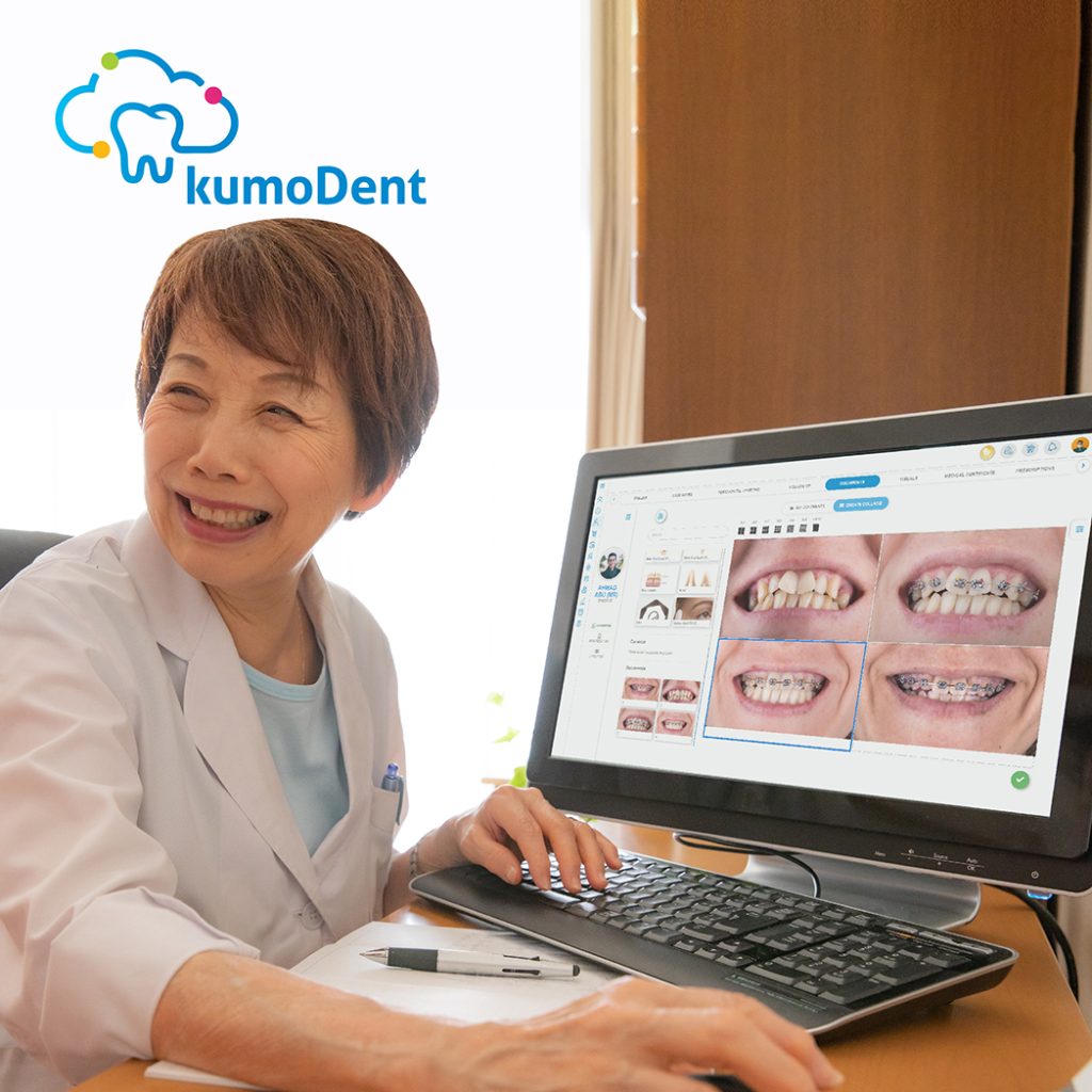Software klinik gigi kumoDent™ menyediakan rekam medis gigi dan odontogram gigi untuk mendukung peningkatan kualitas perawatan pasien.